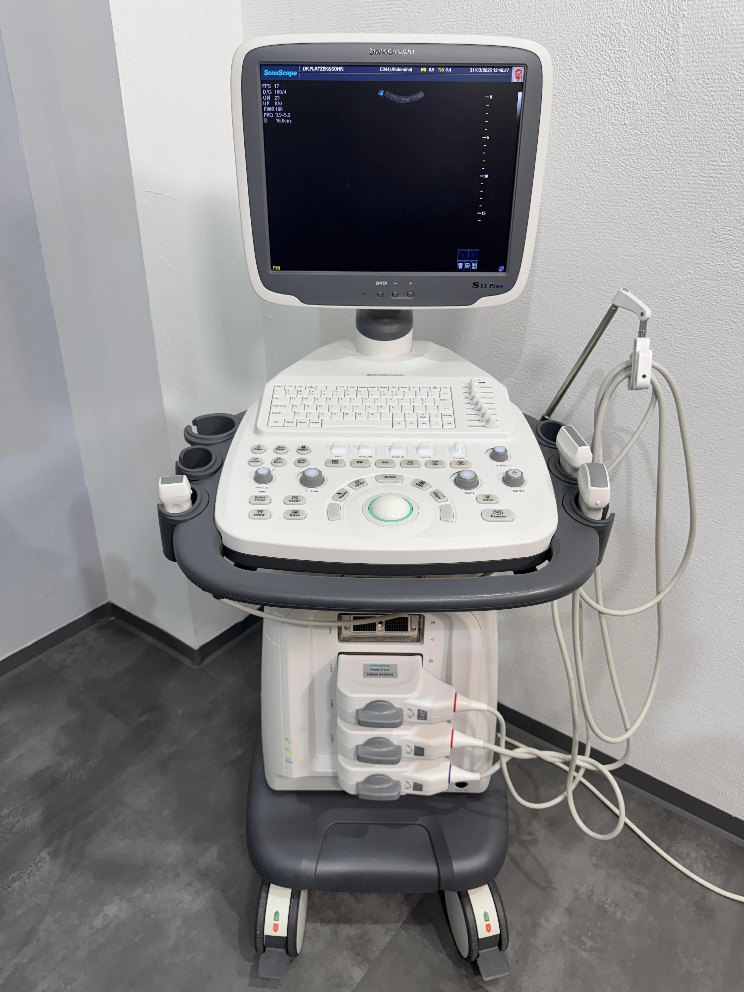 SonoScape S11 Plus 4D Color Doppler Ultrasound with Convex & Linear Probes