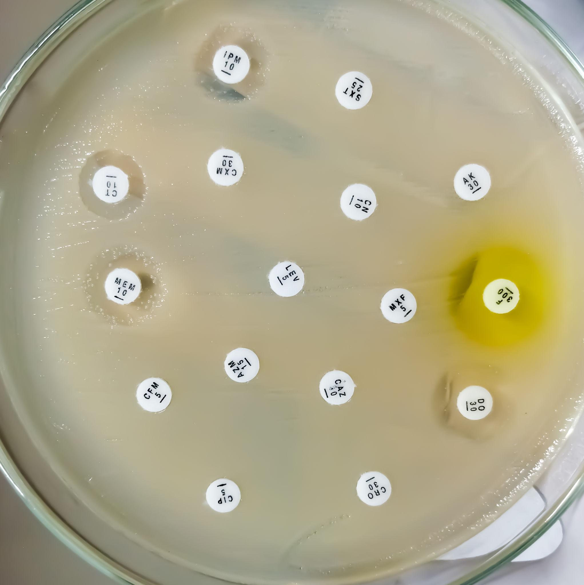 Antibiotic Susceptibility Discs (AST / Antibiotic Sensitivity Discs)