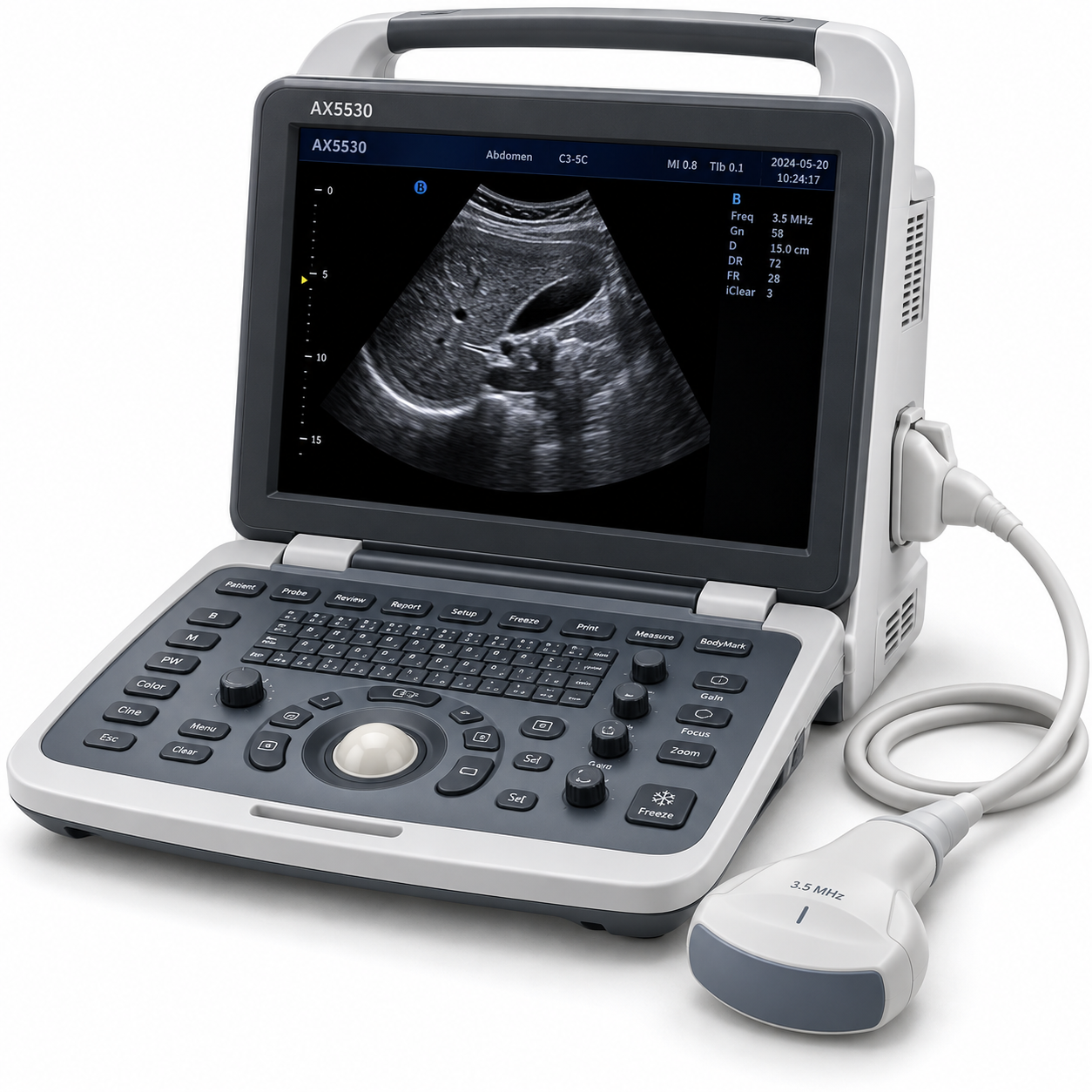 AX5530 Full Digital Ultrasound Scanner with 3.5MHz Convex Probe - View 1