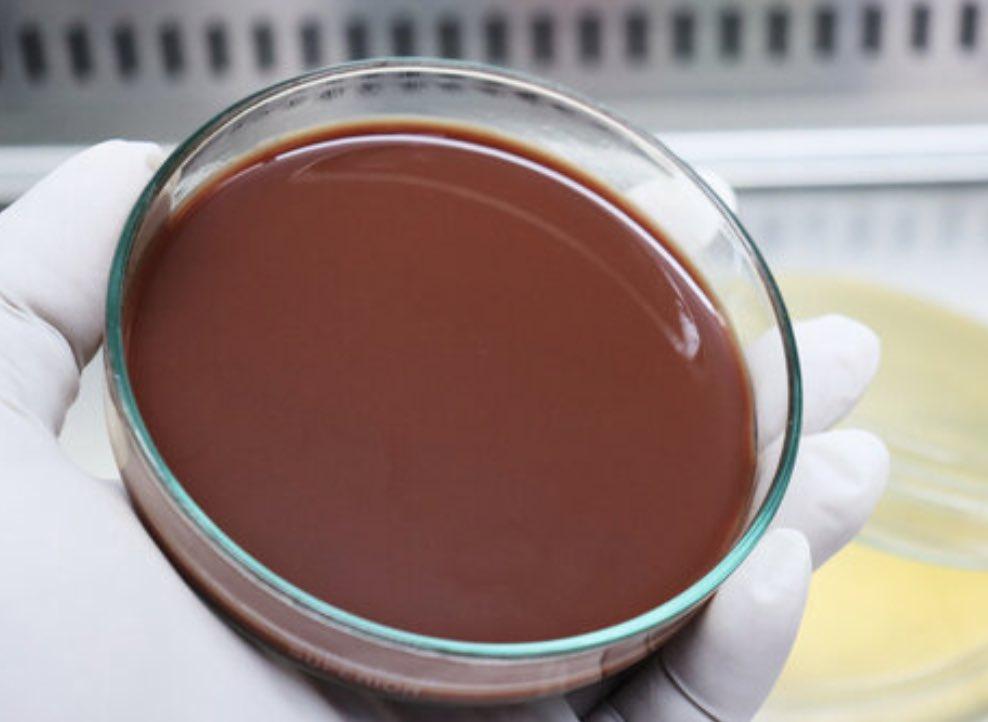 Chocolate Agar – Enriched Microbiology Culture Medium