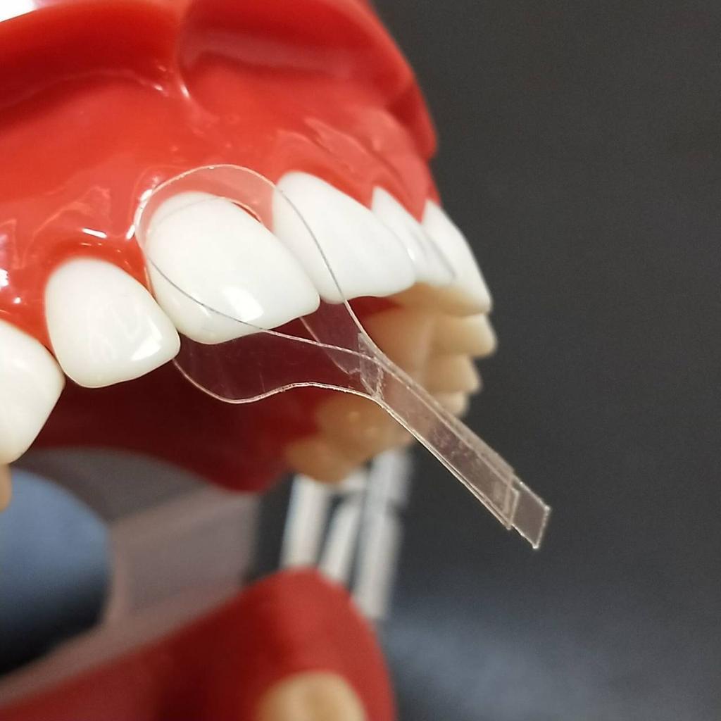 Dental Transparent Matrix Strips – Clear Polyester Restorative Strips
