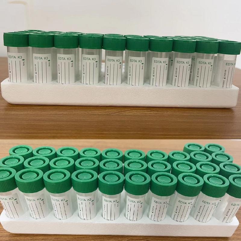 Laborex Non-Vacuum K3 EDTA Tube 5mL – Green Cap, 1000 Pcs-Carton