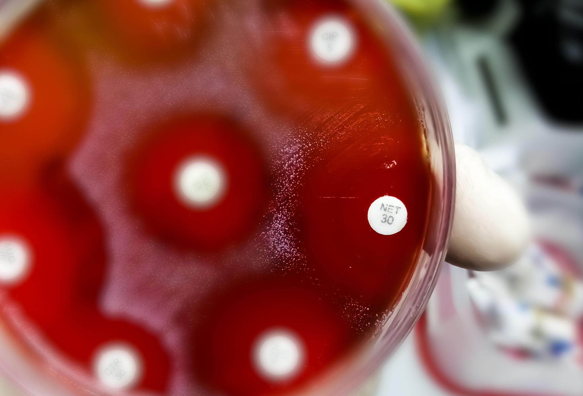 MAST Netilmicin 30µg Antibiotic Susceptibility Discs – 5 × 50 Discs - View 1