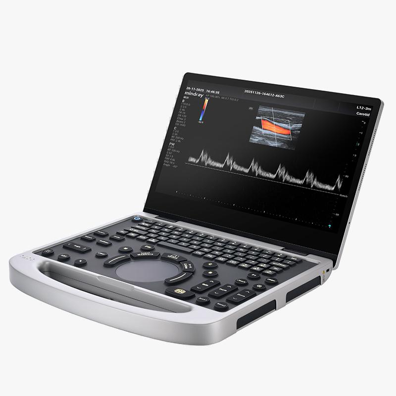 Mindray MU7 Compact Colour Doppler Ultrasound Machine - With Two Probes - View 1