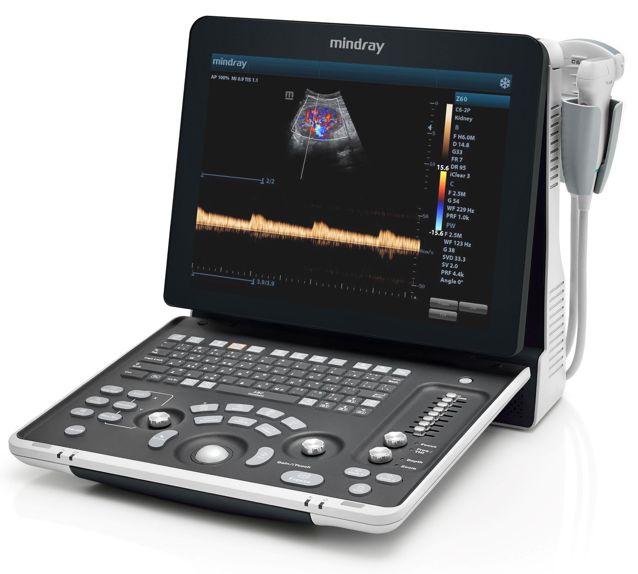 Mindray Z60 Color Doppler Ultrasound with 2 Probes - View 1
