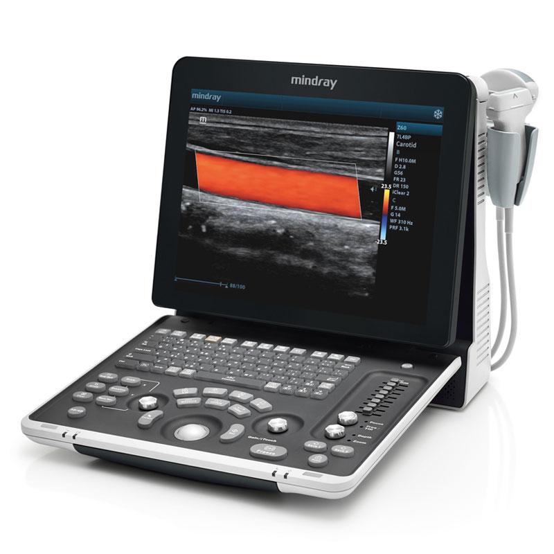 Mindray Z60 Expert Color Doppler Ultrasound with Convex & Linear Probes - View 1