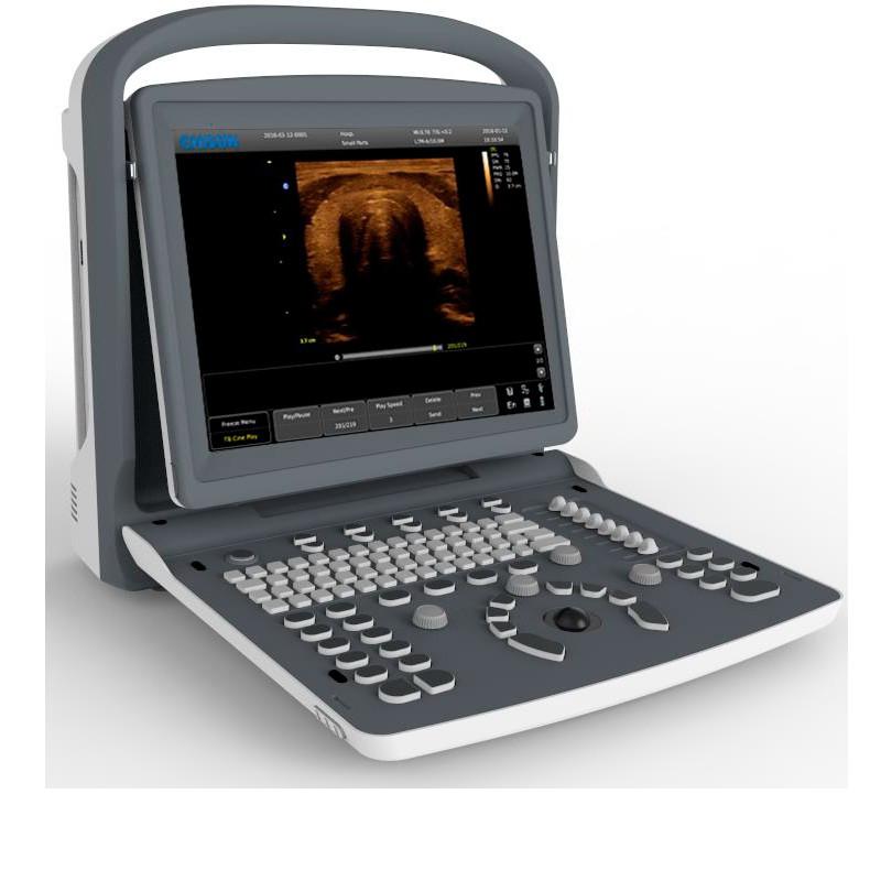 CHISON ECO2 Portable Black & White Ultrasound System with Convex Probe - View 1