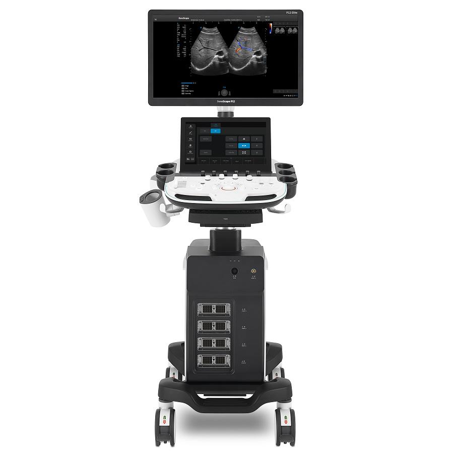 SonoScape P12 Elite Color Doppler Ultrasound Machine