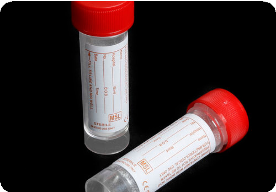 Sterile Universal Sample Container - View 1