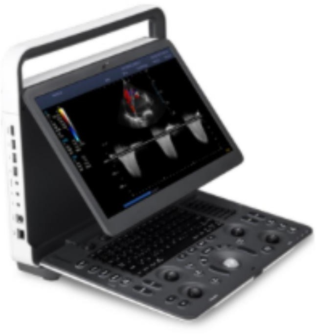 SonoScape E2 Portable Color Doppler Ultrasound System with Linear & Convex Probes