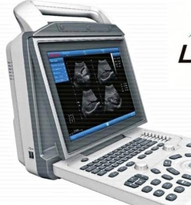 Zoncare i50 Portable B&W Ultrasound with Convex Probe