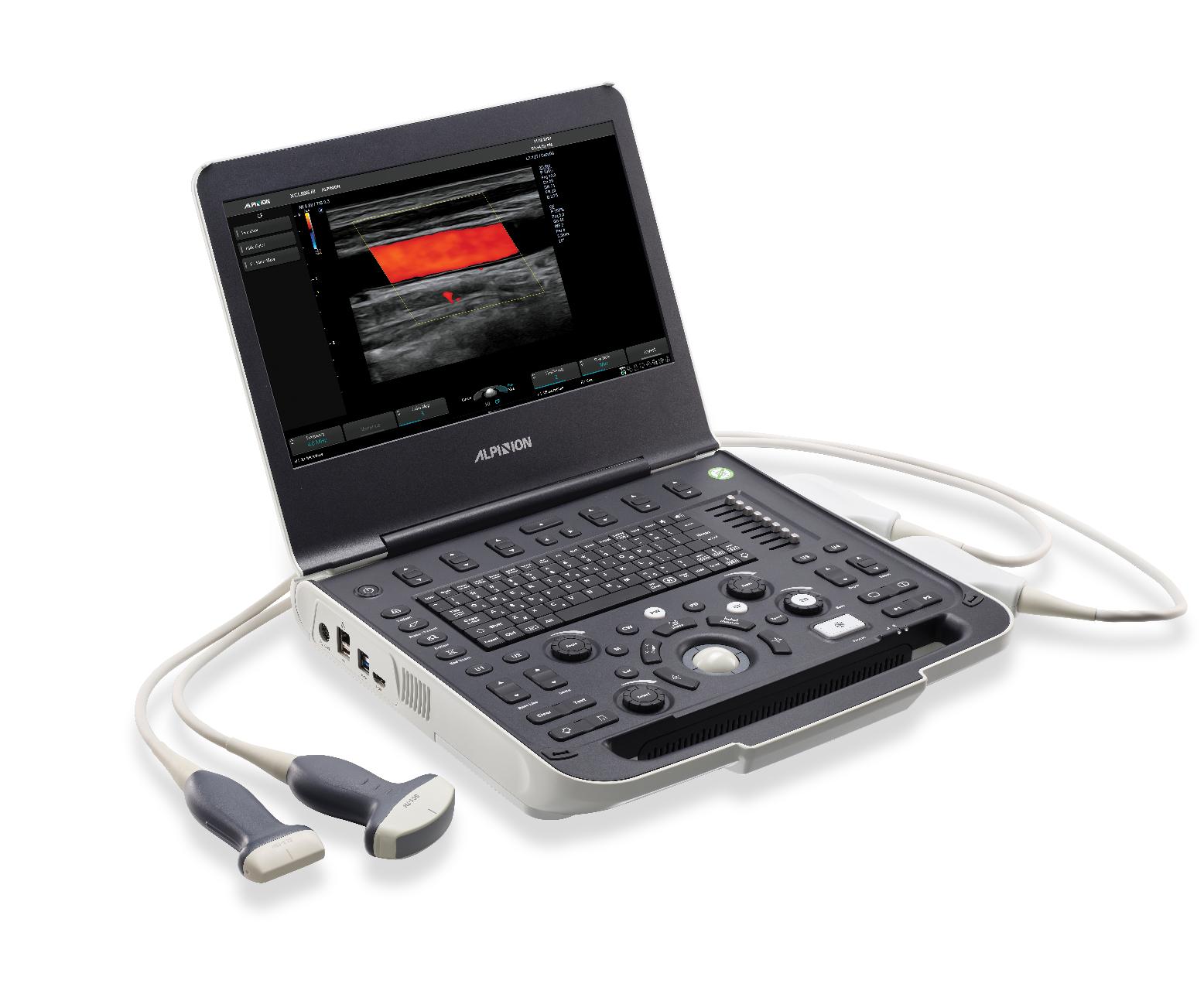 ALPINION X-CUBE i8 Portable Color Doppler Ultrasound with Convex, Linear & Transvaginal Probes - View 1